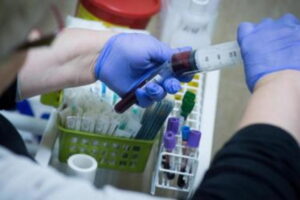 Read more about the article Selen, cynk i inne. O czym może świadczyć ich poziom w organizmie?