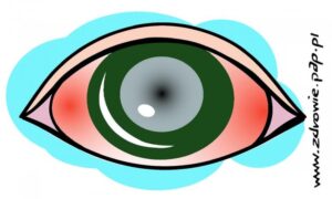 Read more about the article Zdrowie (i choroby) wypisane w oczach