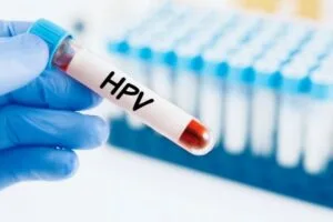 Read more about the article Nie ma na niego lekarstwa, na wakacjach łatwiej się zarazić – 7 faktów o HPV