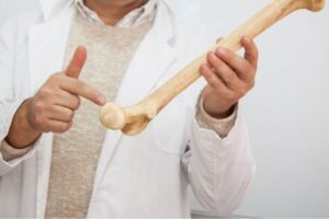 Read more about the article Hipofosfatazja – choroba kruchych kości wyklucza z samodzielności