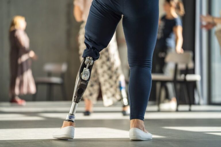 Read more about the article Potrzebujesz dofinansowania do protezy lub rehabilitacji? Fundacja Poland Business Run szuka beneficjentów