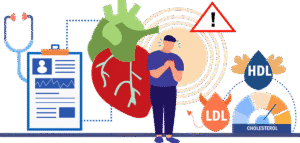 Read more about the article Wysoki cholesterol to cichy zabójca