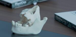 Read more about the article Wsparcie z Funduszy Europejskich pomaga lubelskiej „sztucznej kości” podbijać świat